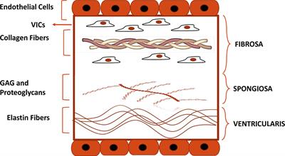 Calcific Aortic Valve Disease-Natural History and Future Therapeutic Strategies